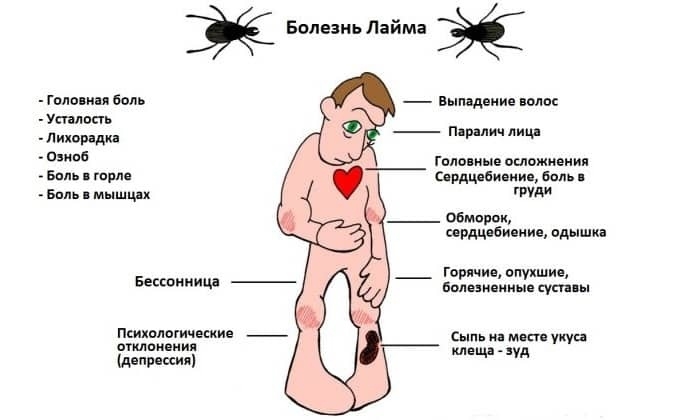 План обследования при клещевом боррелиозе